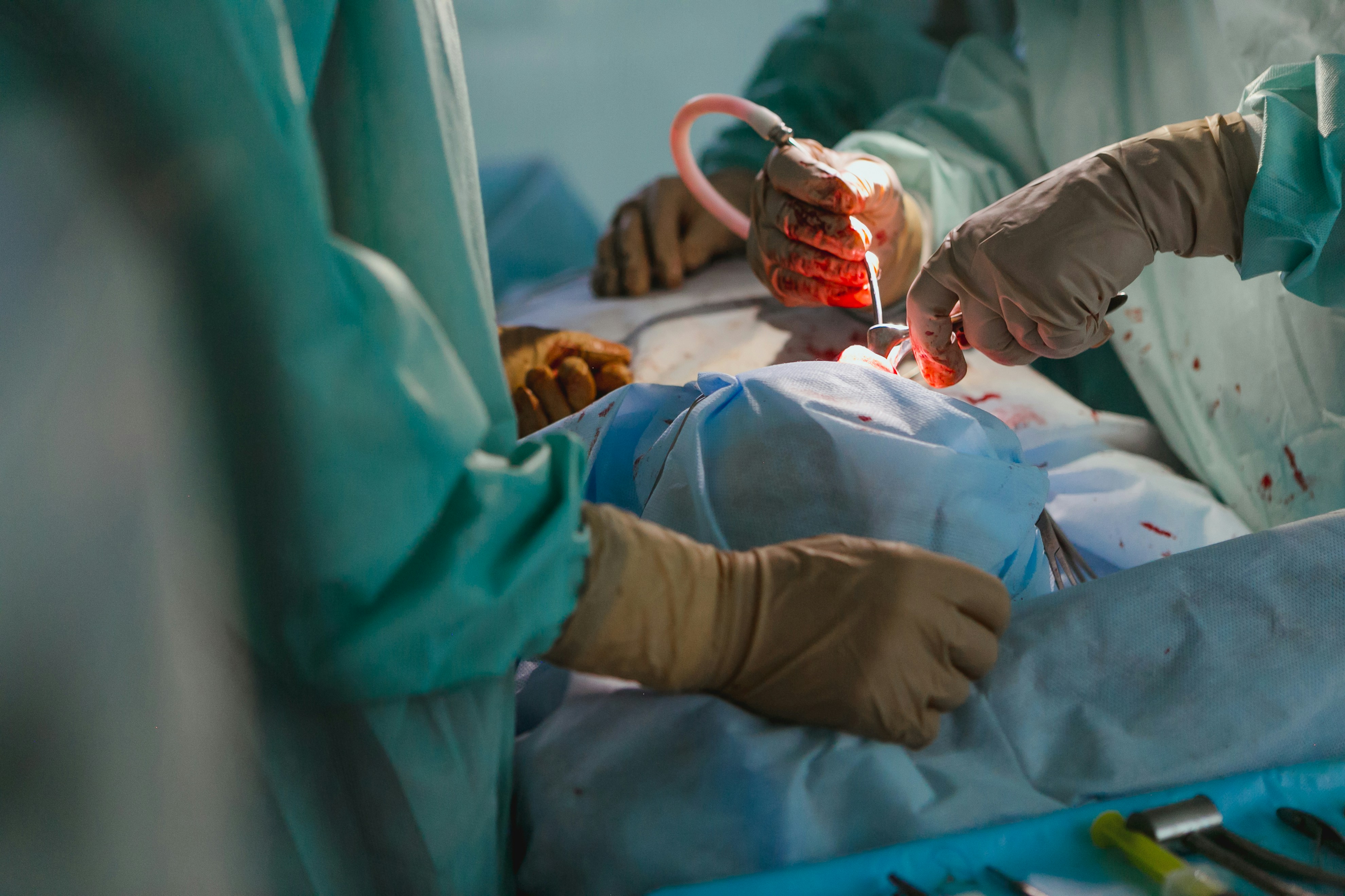 Surgical team performing procedure